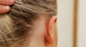 autiaerotimatiko_118554400