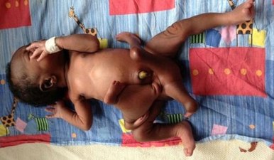 ouganta_agori_4podia_4xeria_692994250