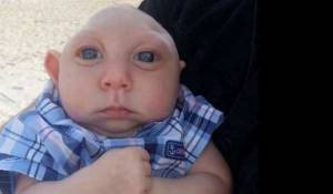 moro_xoris_610401877